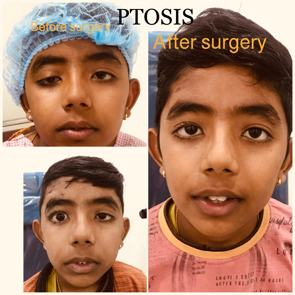 Throat surgery in Ahmedabad
